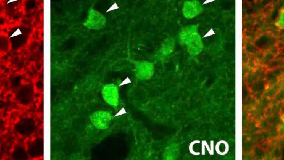 Indirekta banans celler i striatum som aktiveras av receptorproteinet. Grön färg visar på ökad aktivitet. Bildkälla: Angela Cenci Nilsson