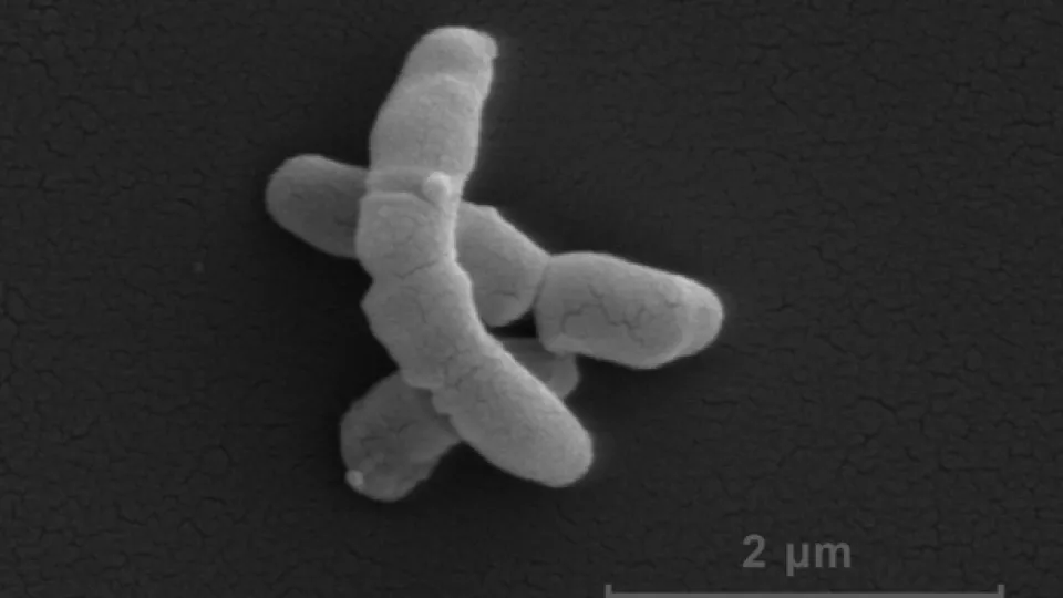 Bakterien Propionibacterium acnes sedd genom elektronmikroskop. (Bild: Matthias Mörgelin, LU)