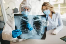 Läkare tittar på en lungröntgen
