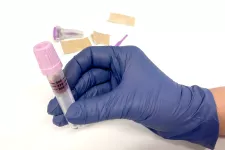 En hand med blå skyddshandske håller i ett provrör för blodprov. I bakgrunden ses plåster och en fingerprickare. foto.