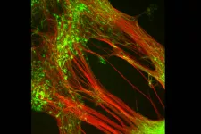 Dopaminproducerande nervceller som forskare från Lunds universitet odlat fram i laboratorium från humana embryonala stamceller. Foto.
