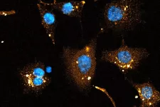 bild på dubbelsträngade RNA-molekyler, siRNA, som levererats till livmoderhalscancer-celler (cellkärnorna visas i blått). Den diffusa orangea signalen runt kärnan är från RNA som nått det inre av cellen, cytosolen. foto.