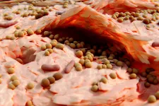 Eksemhud med Staphylococcus aureus. Foto: iStock