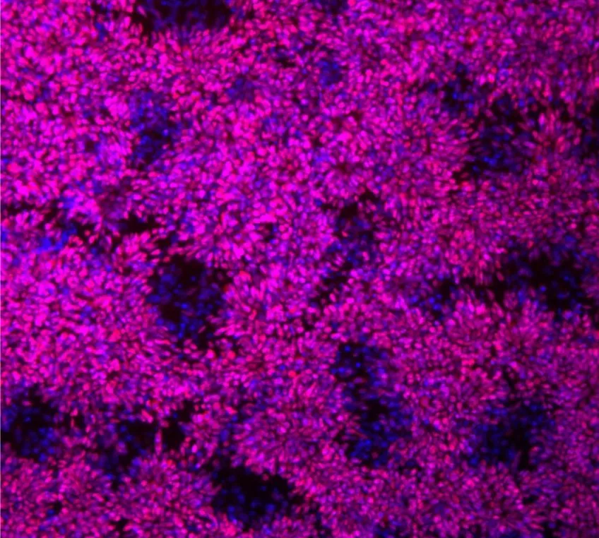 bild på neurala stamceller från schimpans. foto.