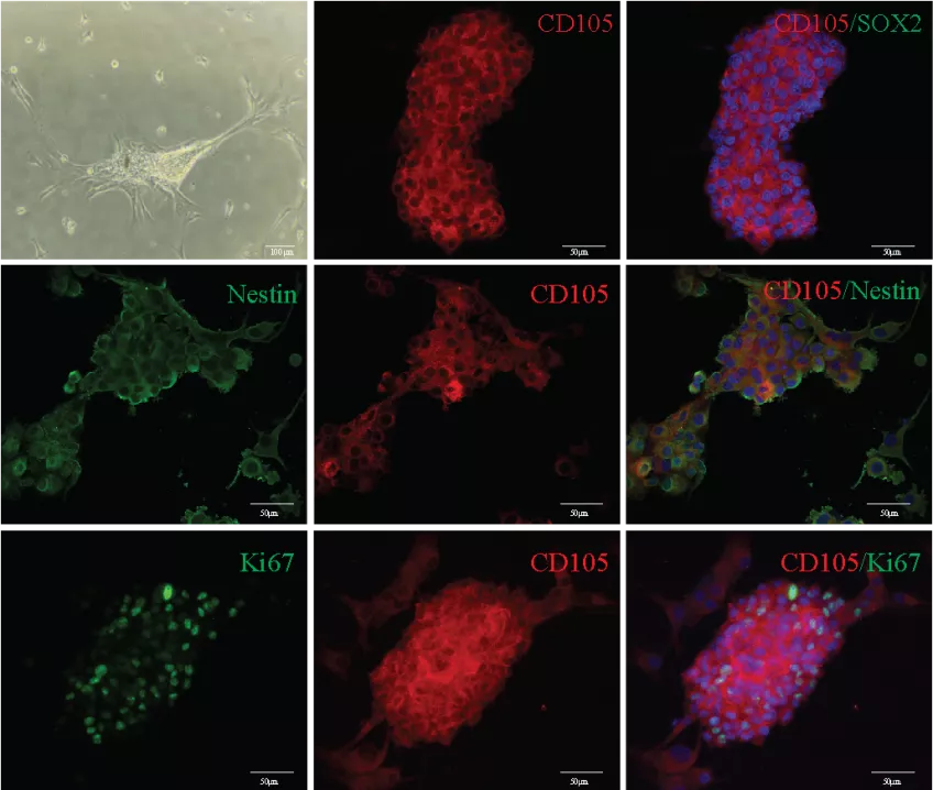 Bilder på den stamcellsliknande cellen CD105, här avbildad med avancerade bildtekniker. Foto.