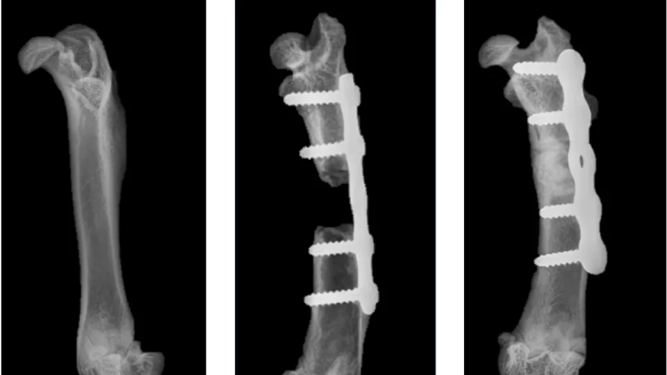 Röntgenbilder som jämför ett friskt lårben med en fraktur som behandlats med och utan den nya metoden, där den sistnämnda helt läkt.