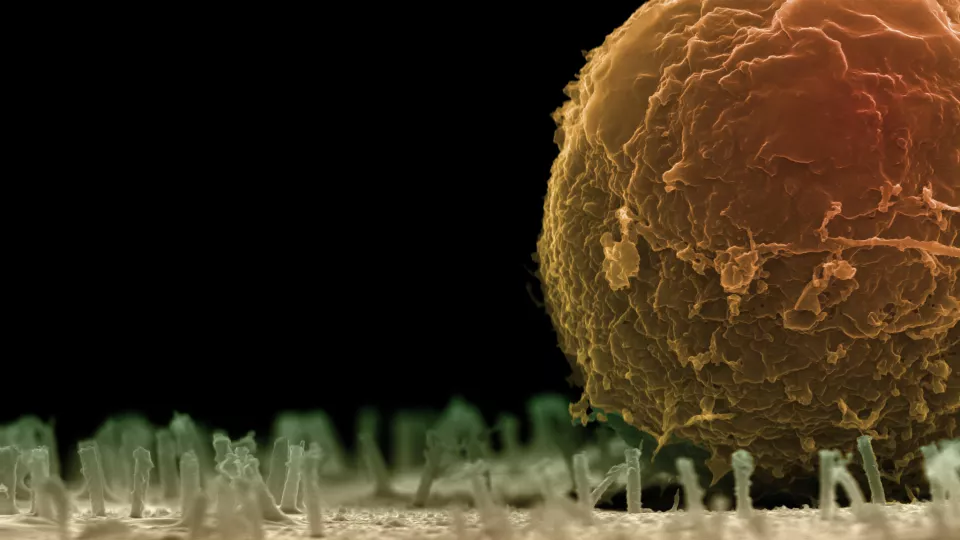 Blodstamcell inzoomad. Foto: Martin Hjort.