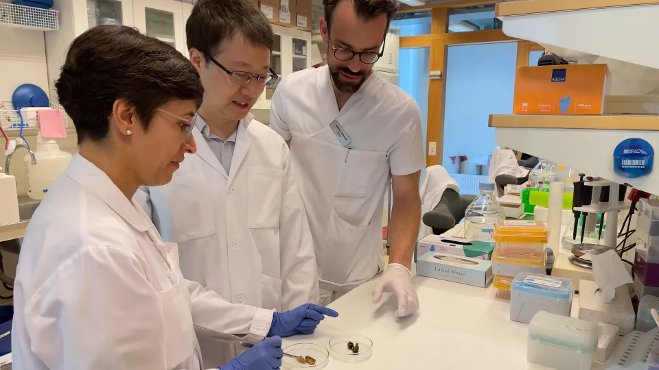 bild på Isabel Goncalves, Jiangming Sun och Andreas Edsfeldt studerar åderförfettningsplack från två patienter. Studien i JACC bygger på ett nära samarbete mellan kliniskt verksamma forskare och experter inom bioinformatik. Foto.