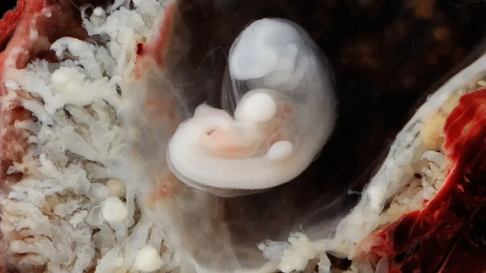 Foto på ett cirka 7 veckor gammalt humant embryo omgiven av moderkakan