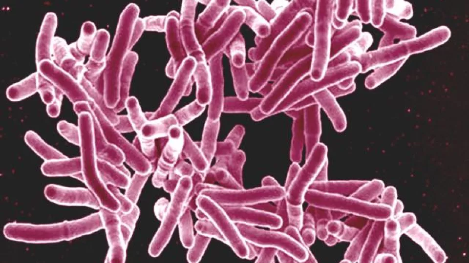 bild på tuberkulosbakterier