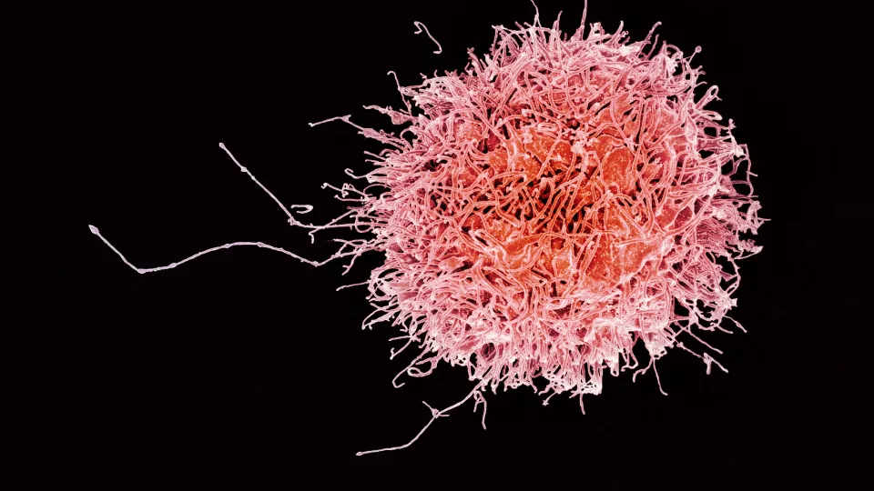 Bild på en NK-cell, natural killer cell. Bildkälla: NIAID