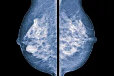 röntgenbild av bröstcancer. foto.