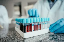 En behållare med blodprovsrör. Foto: iStock