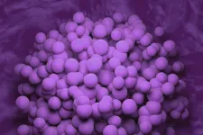 Bild av glioblastom infärgad i lila. Foto: iStock