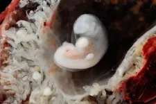 Foto på ett cirka 7 veckor gammalt humant embryo omgiven av moderkakan