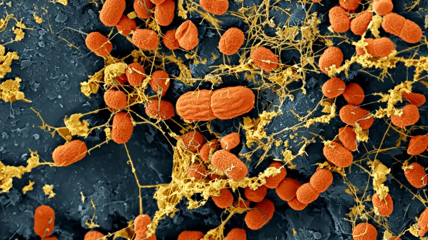 Mirkoskopbold på bakterier. 