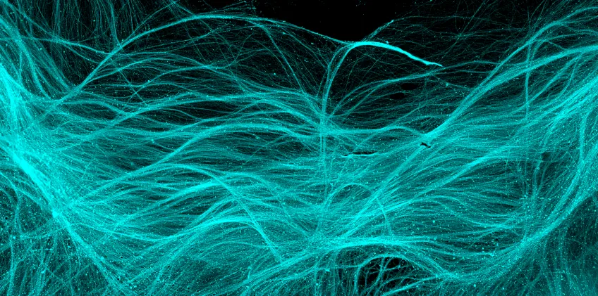 Fibrer från dopaminceller odlade i cellkultur. (Foto: Kirkeby Lab, ReNEW, Köpenhamn)