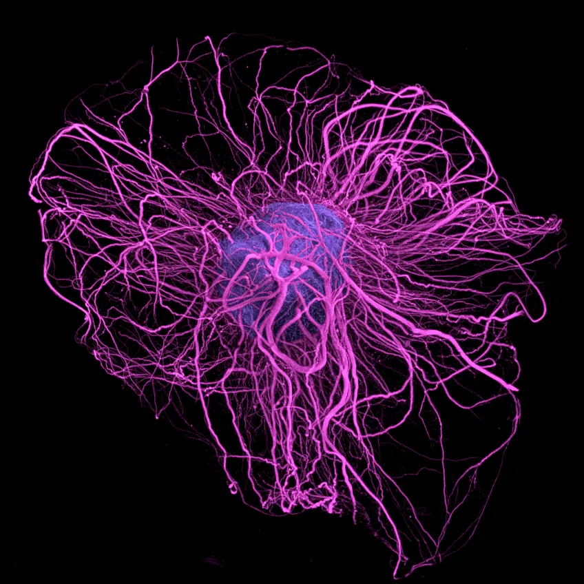 Dopamine neurons grown in culture in 3D (Photo: Parmar lab, Lund University, Sweden)