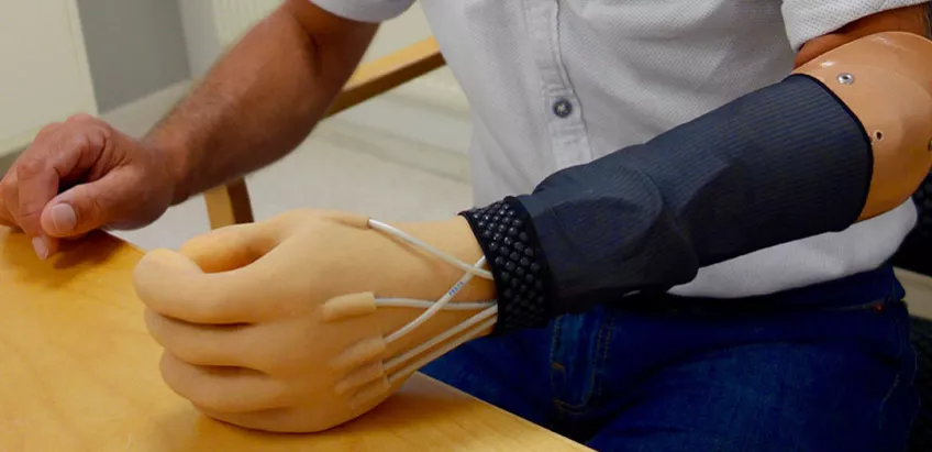 Luftkuddar i protesens fingerspetsar förflyttar trycket genom slangar vid olika punkter på armen och på användarens känselkarta. Lufttrycket som uppstår vid beröring ger användaren en upplevelse av känsel i den förlorade handen. Foto: Ulrika Wijk